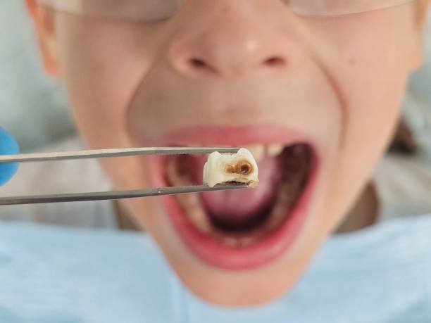 Best Knocked-Out Tooth Emergency  in Norwood, PA
