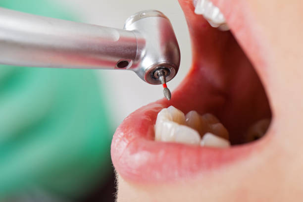 Best Cracked Tooth Emergency Dentist  in Norwood, PA